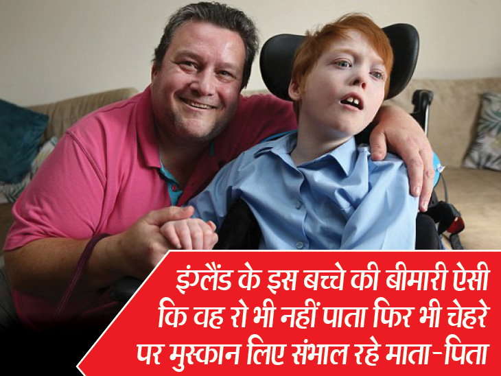 मेडिकल साइंस के लिए पहेली बना 11 साल का बेंजामिन, मासूम को है ऐसी बीमारी जिसका कोई नाम ही नहीं