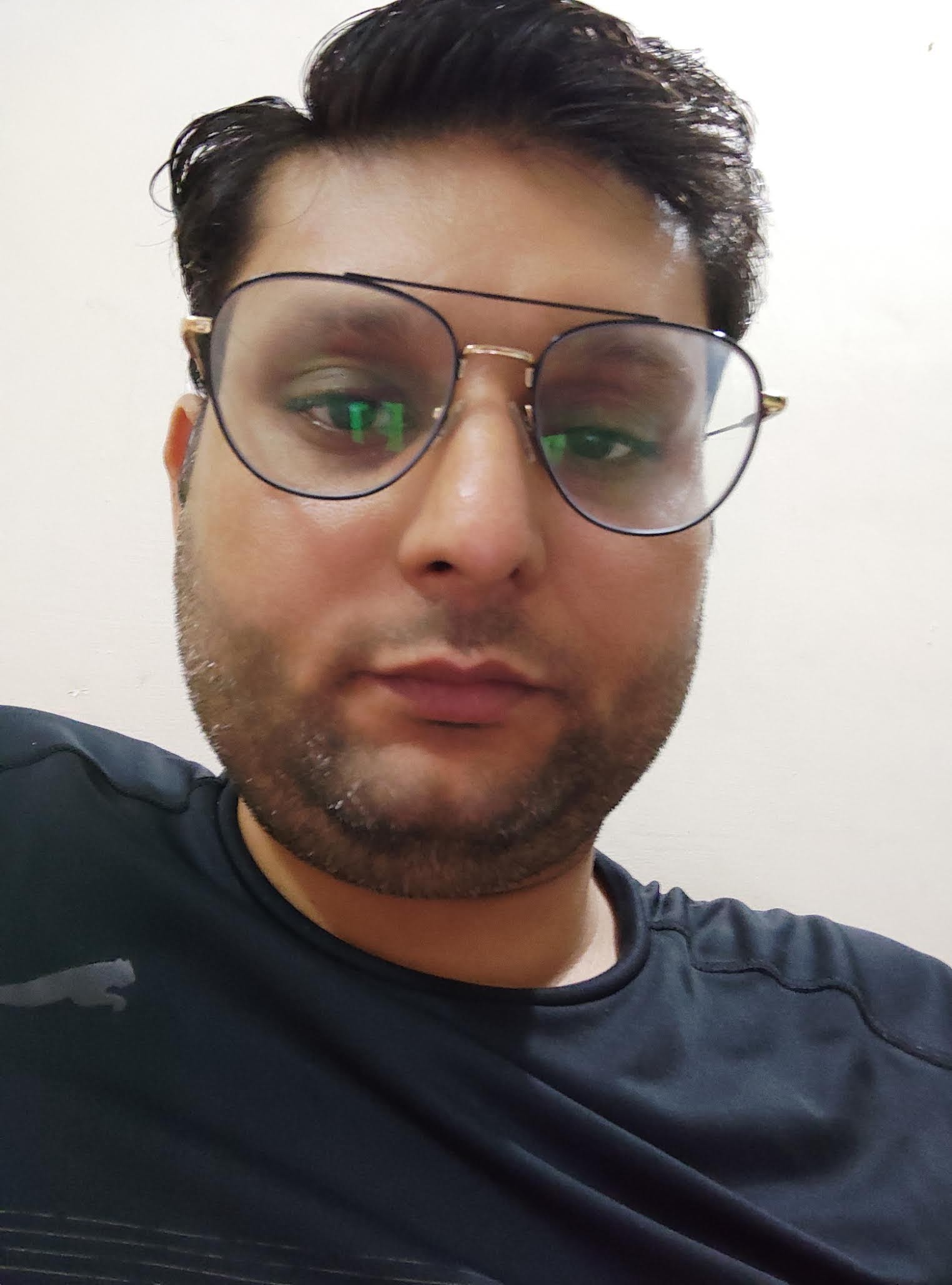 अंबाला में आदेश अस्पताल ने रचा इतिहास, आई.वी.एल. तकनीक से जटिल हार्ट सर्जरी सफल